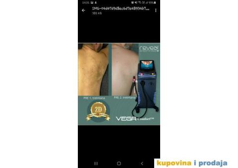 Laser za epilaciju Vega Reveal Comfort - 9/10