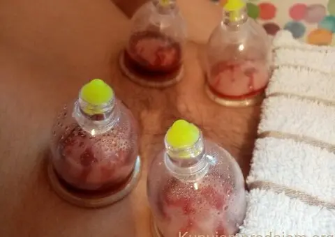 Hidzamom do balansa - 2/5