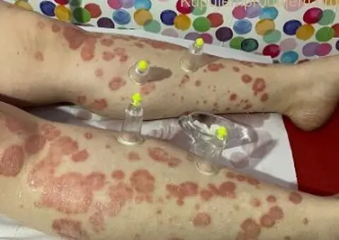 Hidzamom do balansa - 4/5