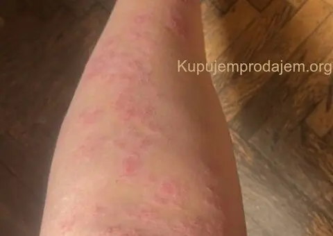 Hidzamom do balansa, Jaca - 2/3